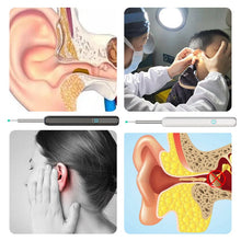 Load image into Gallery viewer, Smart Visible Earpick