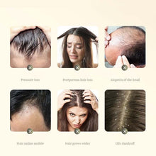 Load image into Gallery viewer, Anti-Hair Loss Ginger Shampoo
