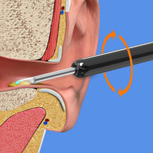 Load image into Gallery viewer, Smart Visible Earpick